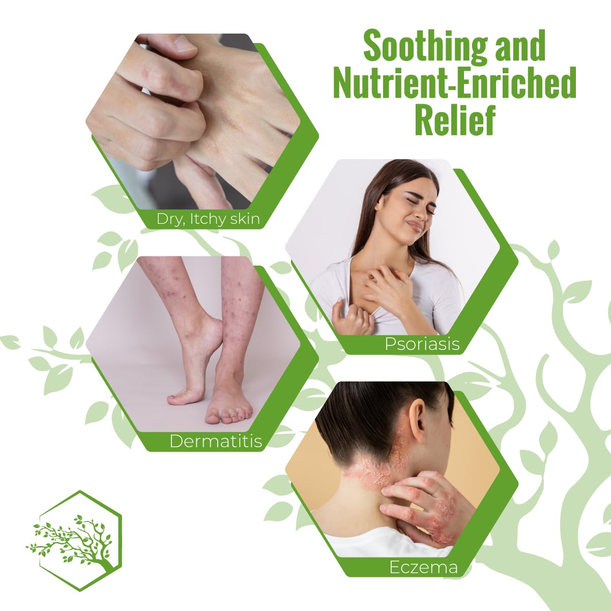 Moisturizing Eczema Body Wash – Gentle Psoriasis Body Wash for Itchy, Dry Skin Relief – Eczema Soap for Redness and Flareups – Hydrating Cleanser for Women and Men