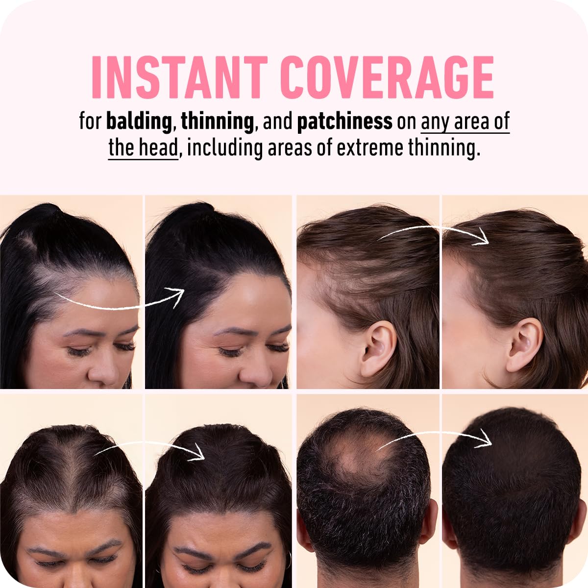 BOLDIFY Hairline Powder - Root Touch Up Hair Color for Gray Coverage - Bald Spot Concealing Hair Powder for Women & Men - 48-Hour Stain-Proof - Dark Brown