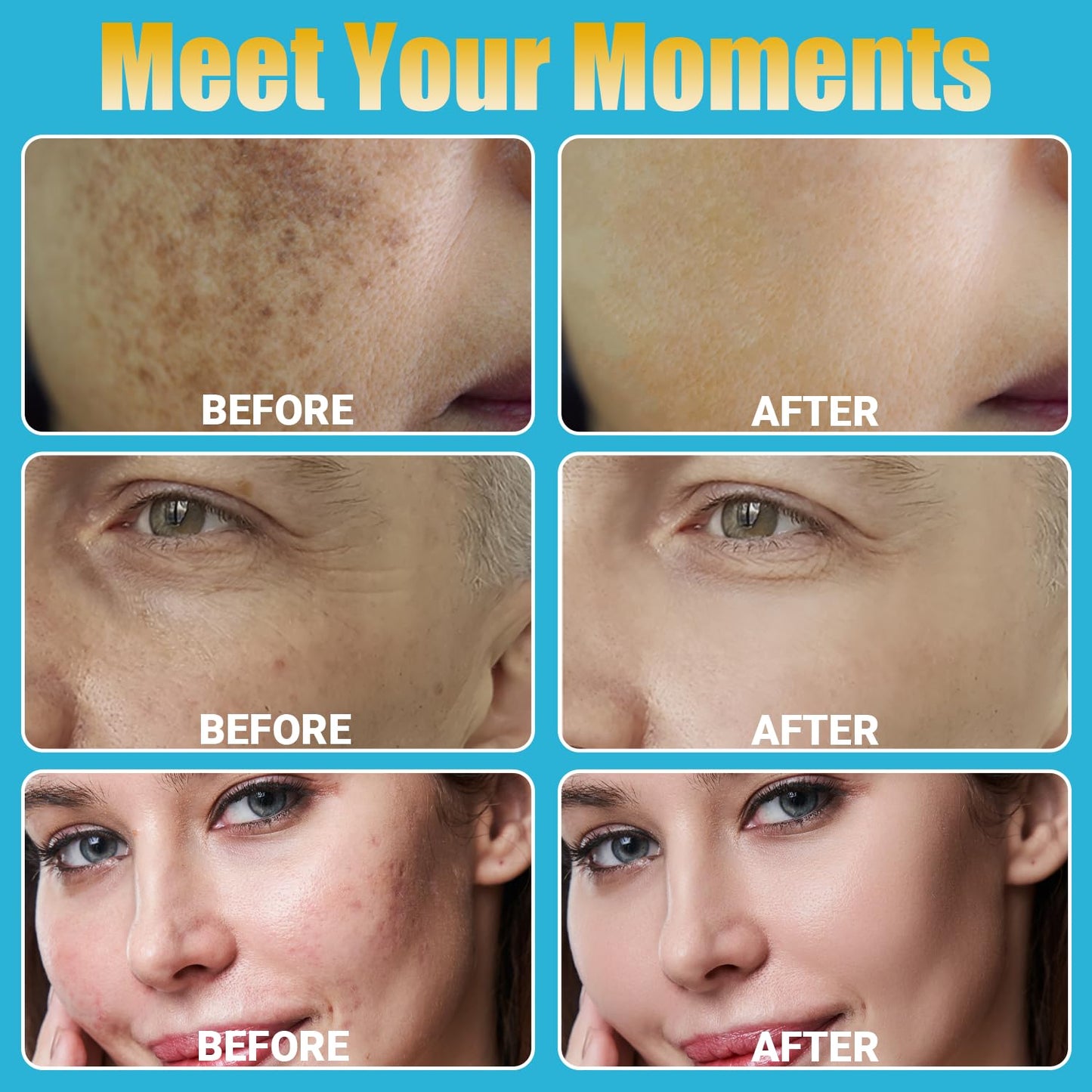 Home Use Microneedling Microneedle Skin Care Beauty Kit Tool for Face Hair Beard