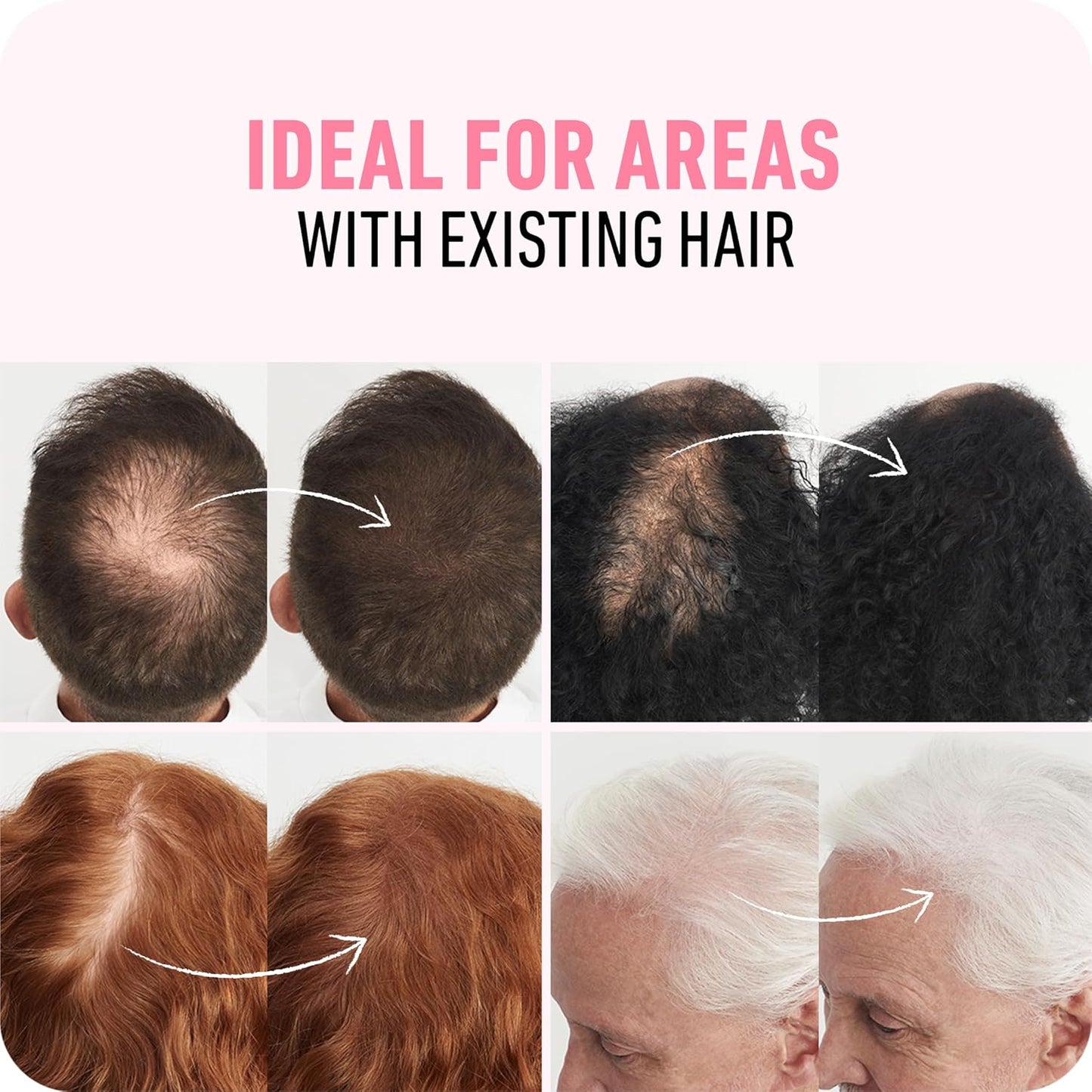 BOLDIFY Hair Fibers (28.5g) - Fill In Thinning and Fine Hair for an Instantly Fuller, Thicker Look - 14 Shades for Women & Men - Light Blonde