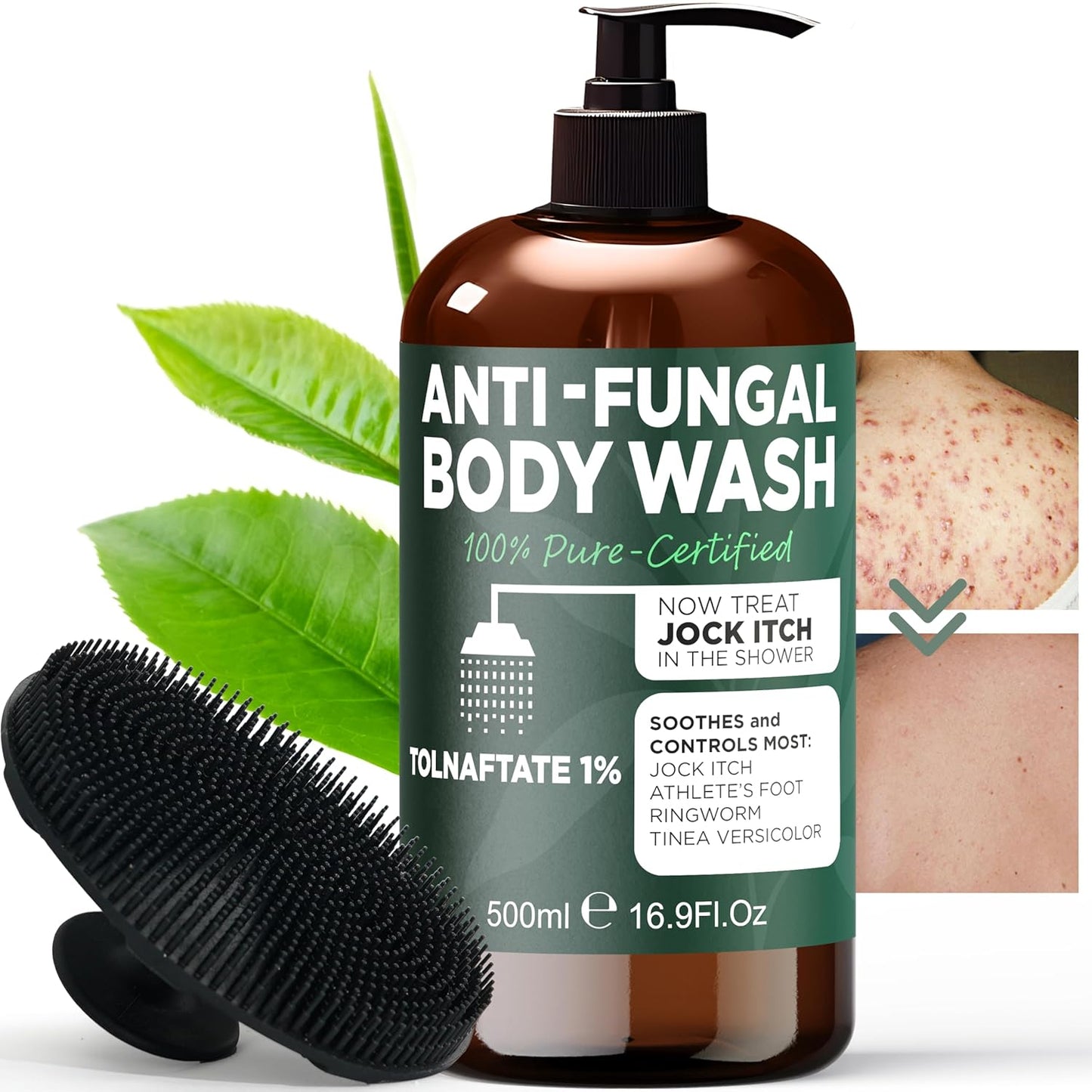 Antifungal Body Wash with Tea Tree Oil | Antibacterial Soap for Back Acne, Eczema & Jock Itch,Treats Ringworm | Antibacterial Body Soap For Men And Women (1% Tolnaftate Medicated Body Wash) 16.9 oz