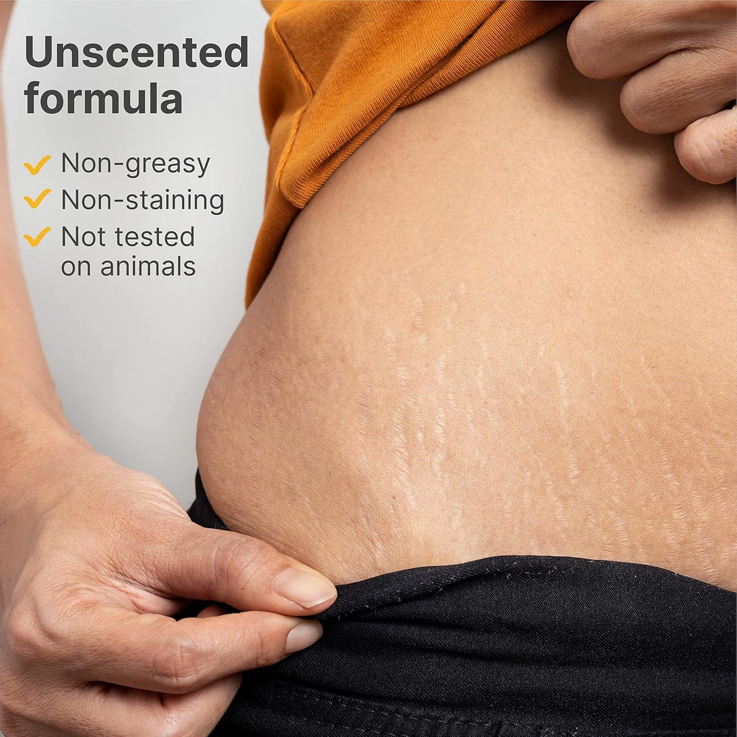 TriLASTIN-SR Intensive Stretch Mark Cream (5.5oz) Bundle with Nipple & Lip Balm (3pk) | Fast-Acting Stretch Marks Cream with Absorption Enhancing Serum | Breastfeeding & Ingesting Safe Balm